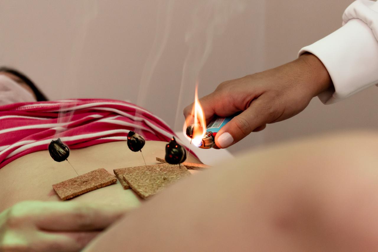 Método Pariens - Acupuntura 1