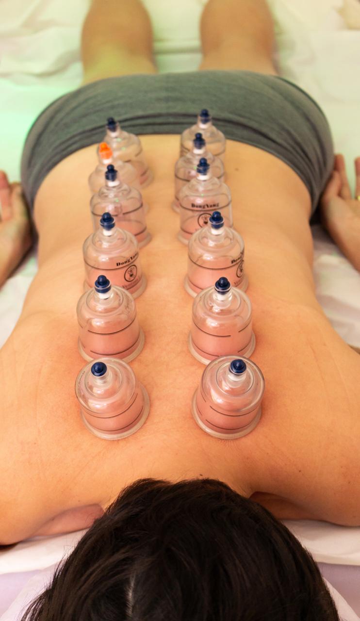 Método Pariens - Acupuntura 2