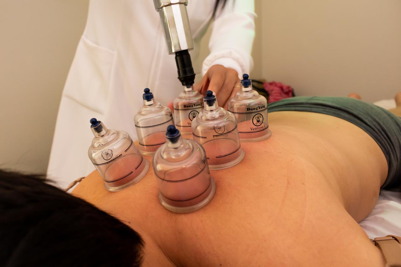 Método Pariens - Acupuntura 4